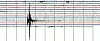 Seismograph Capture